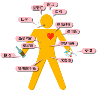 你知道哪些疾病會引發勃起功能障礙嗎？